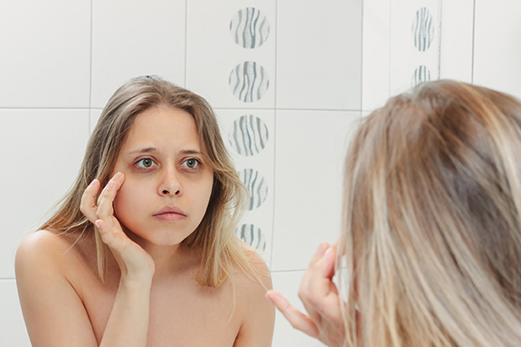 Girl looking at the dark circles under her eyes